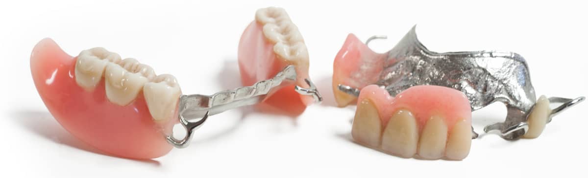 Prothèses dentaires partielles